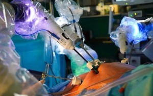 Operacja przy użyciu robota VERSIUS w UCK SUM w Katowicach (4)