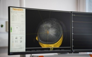 Mapowanie mózgu w UCK w Katowicach (6)