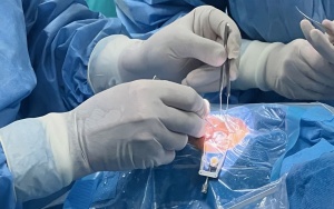 Operacja przeszczepu rogówki w Okręgowym Szpitalu Kolejowym w Katowicach (6)