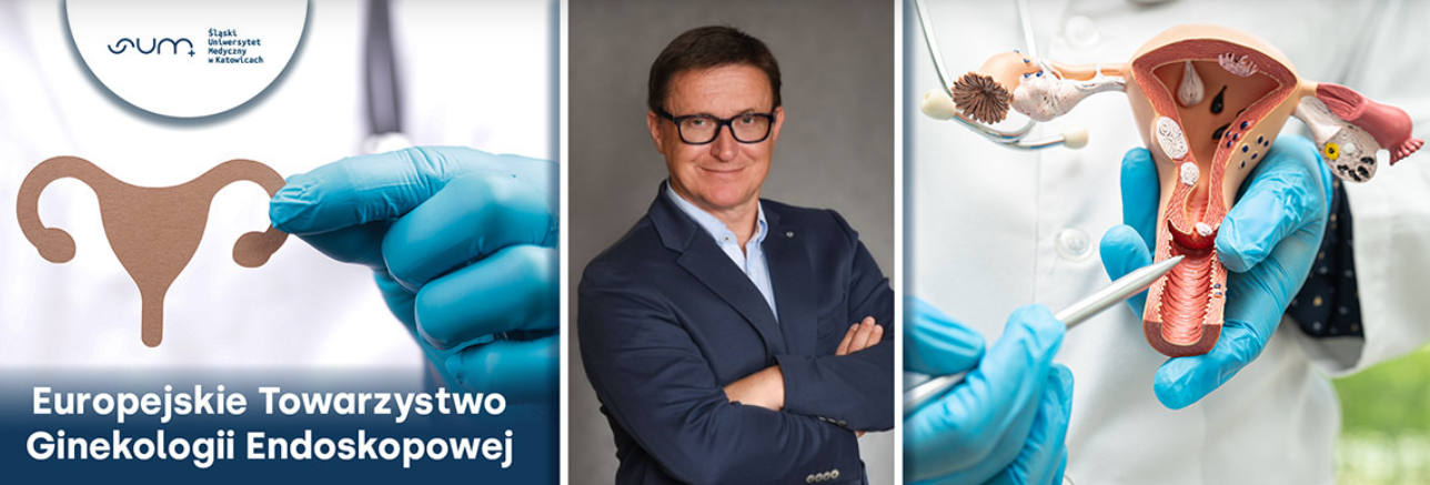 Prof. Rafał Stojko, kierownik Katedry i Oddziału Klinicznego Ginekologii, Położnictwa i Ginekologii Onkologicznej Wydziału Nauk o Zdrowiu w Katowicach Śląskiego Uniwersytetu Medycznego